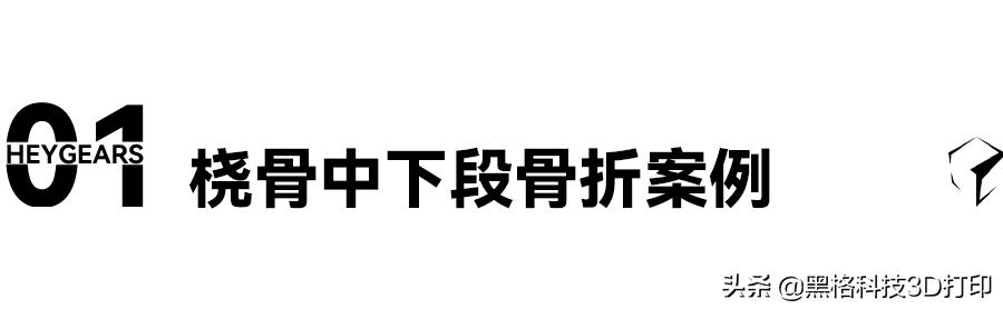 打石膏后为什么会出现瘙痒,打石膏后皮肤变黑怎么办