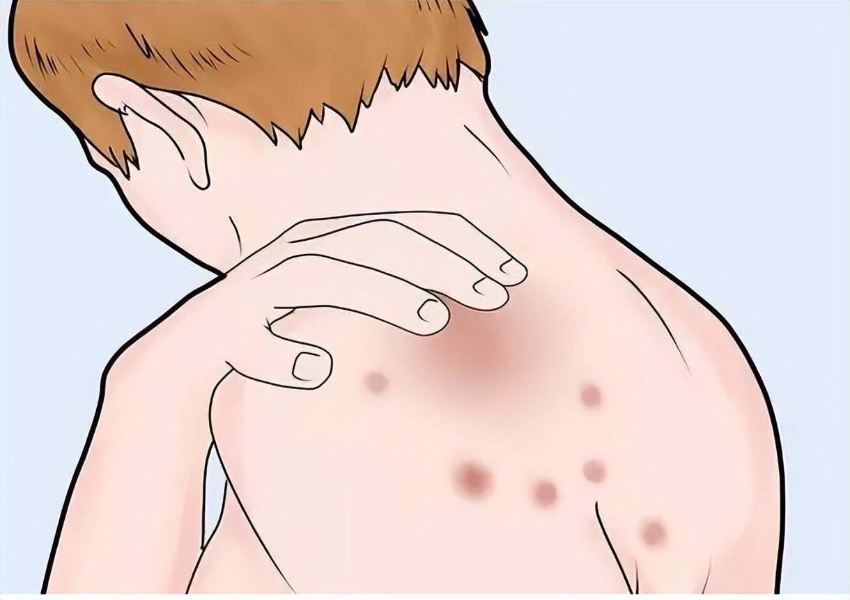 怎么在*生活性**前，判断对象有没有性病？