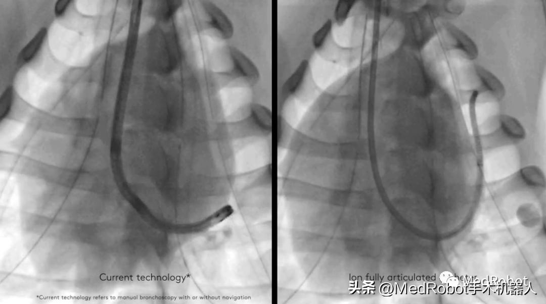 100种仿生机器人,最新全自动机器人
