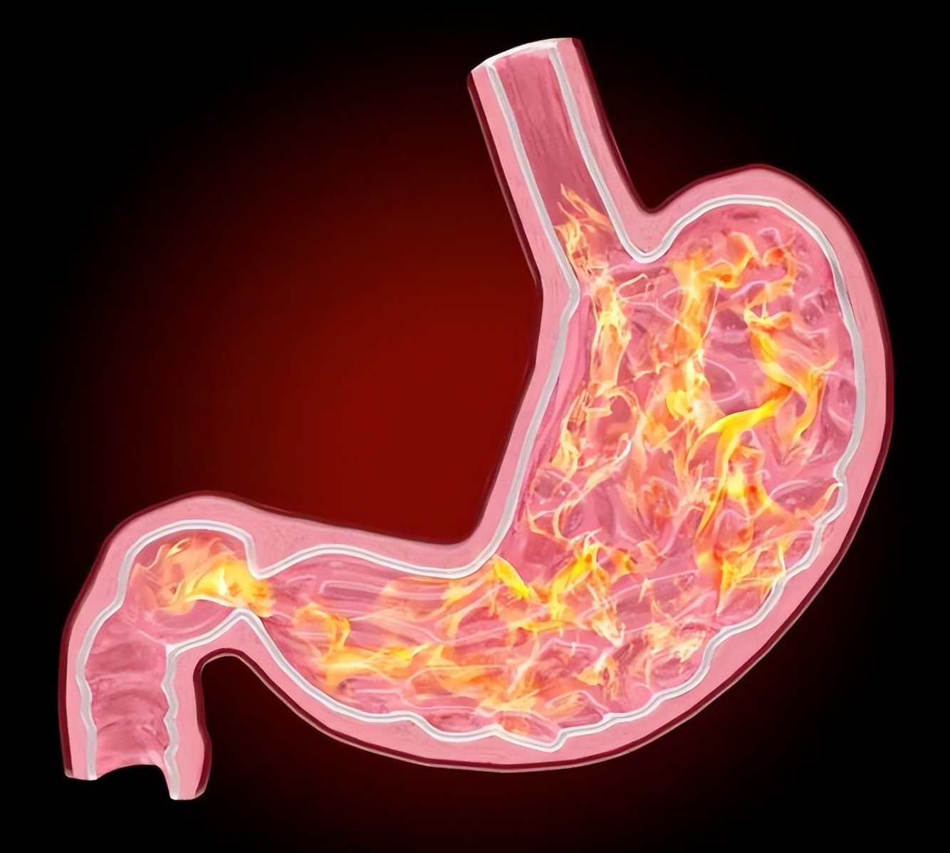 调理胃病的中成药哪种最好,治慢性胃病的西药有哪些