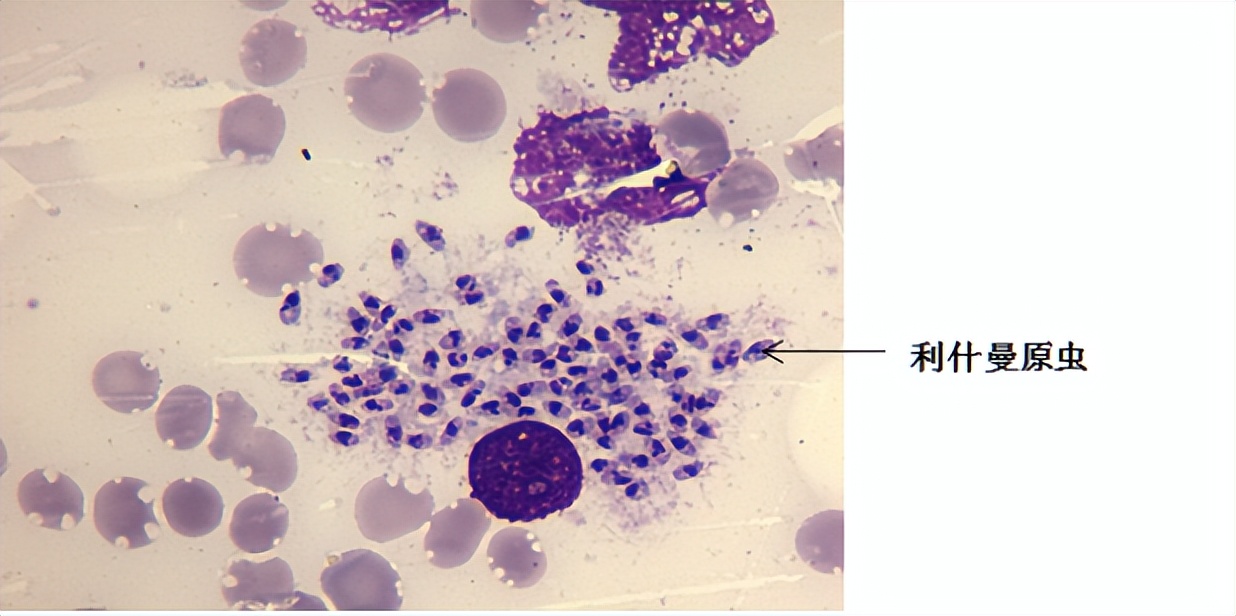哪些寄生虫的感染阶段是虫卵,什么情况下会感染寄生虫