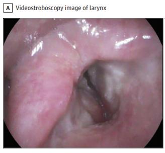 真菌进入口中会怎么样,喉咙真菌感染会致命吗