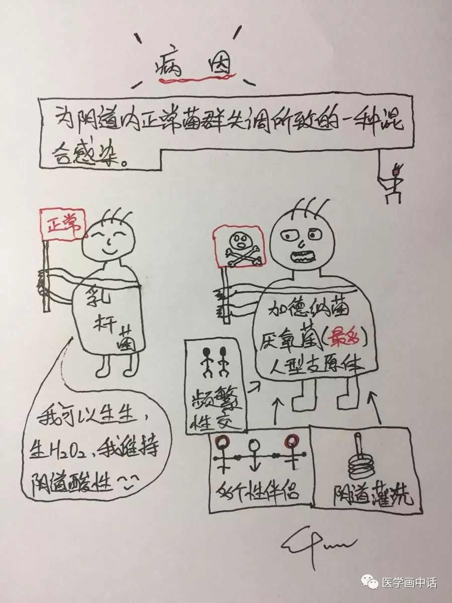 细菌性阴道炎的症状及如何治疗,细菌性阴道炎有哪些症状及治疗