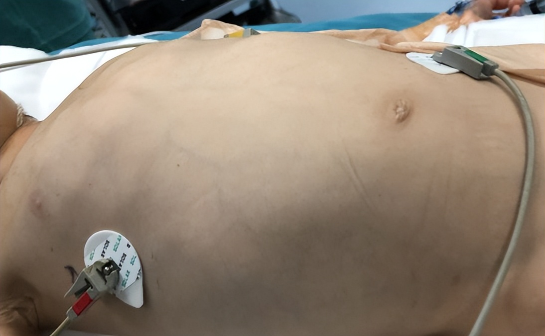 小男孩患虫癌,7岁男孩患虫癌