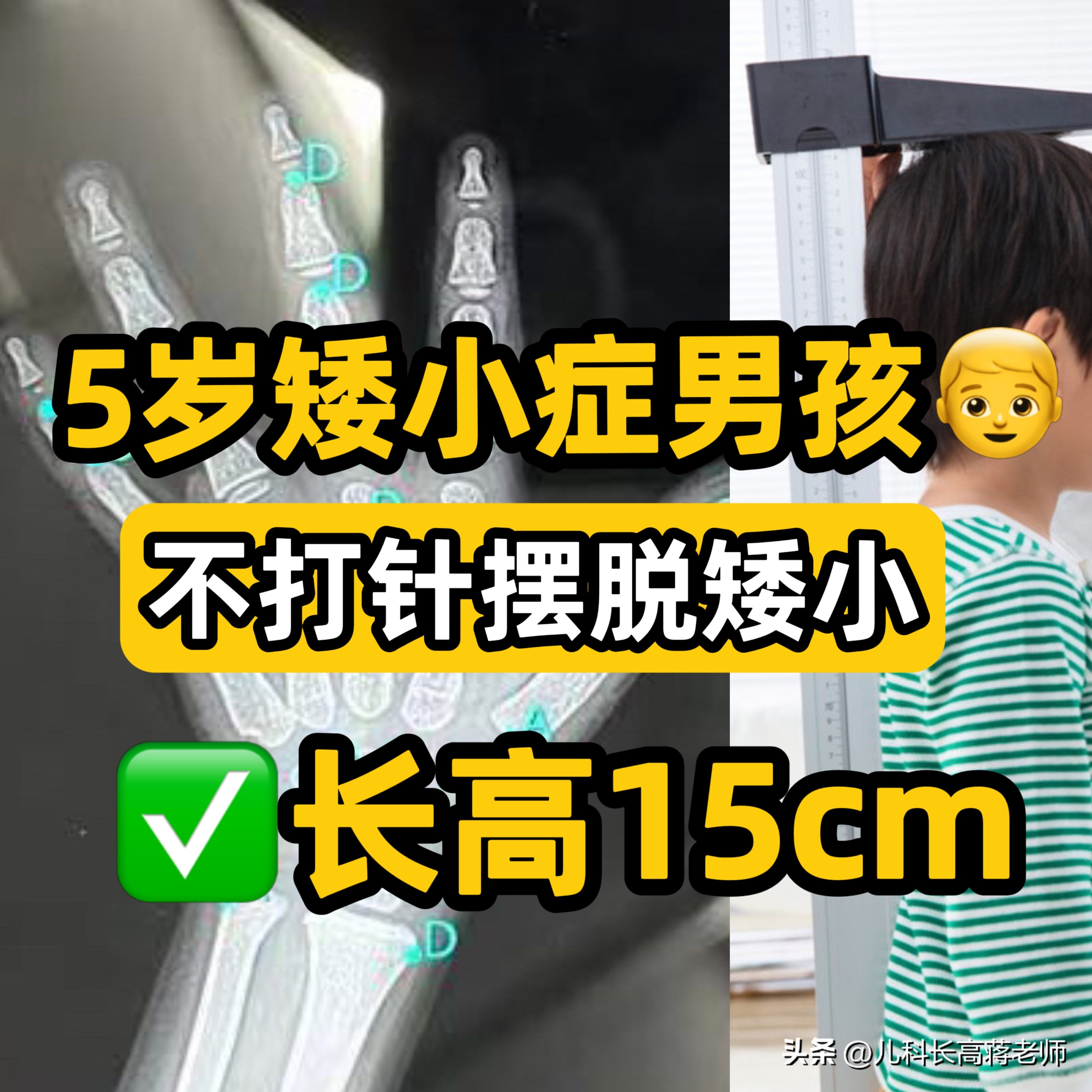 孩子不长个不长肉如何食疗,孩子不长个特别瘦是怎么回事