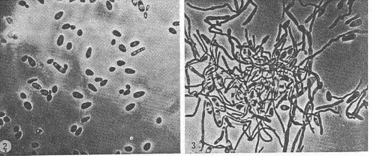 金黄色葡萄球菌的微生物特性,金黄色葡萄球菌的培养特性