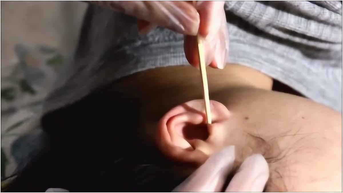 耳朵特别痒又掏不出耳屎怎么办,耳朵里痒一掏就流水是什么原因