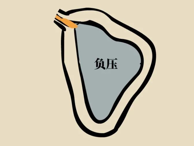 鼻窦发炎眼睛会持续疼还是偶尔疼,为什么得了鼻窦炎头很疼