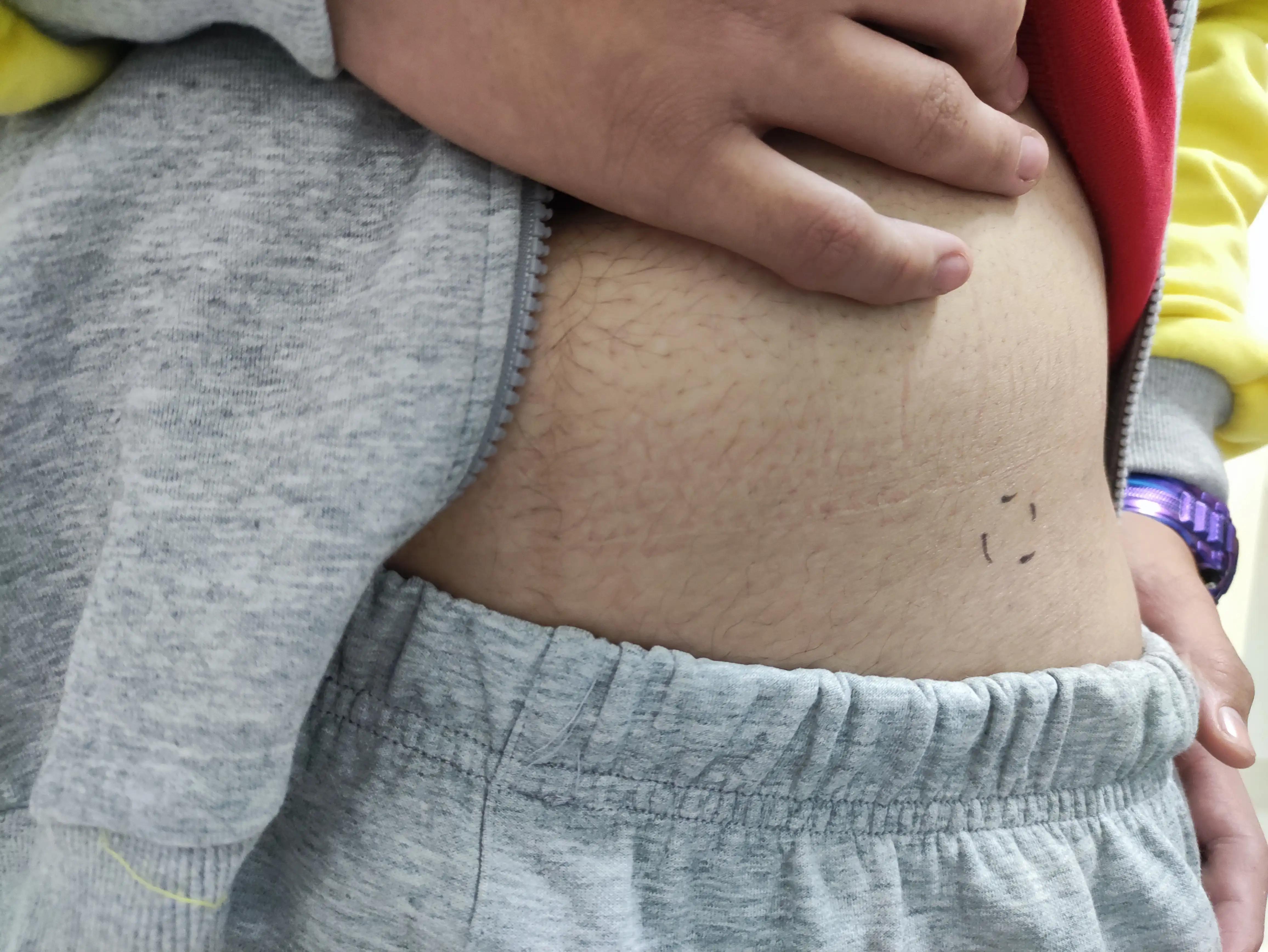 跑完步发现膝盖剧痛怎么办,跑完步为什么腿里有根筋痛