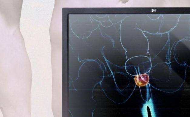 泌尿外科医生最不建议做的3件事,前列腺盲目治疗的误区