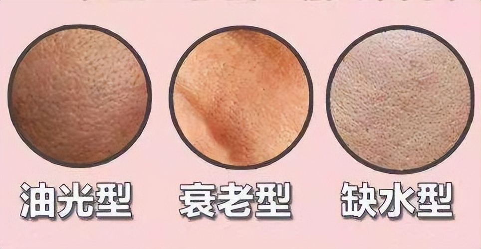 皮秒缩毛孔恢复过程图,去油缩毛孔最好的方法