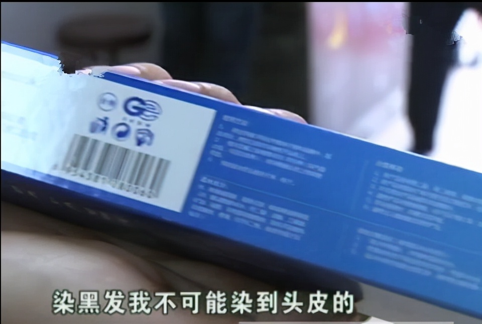 因为染发，我秃了顶.....