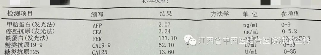 肝癌多发性肝内转移靶向药,肝癌中晚期免疫靶向有奇迹出现吗