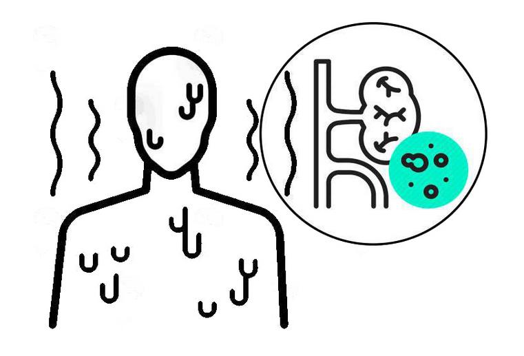 睡到半夜热得全身出汗是什么原因,睡着了热出汗怎么回事