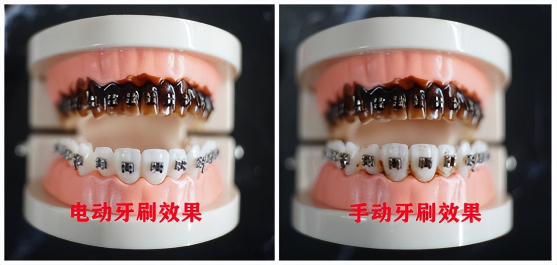 儿童用电动牙刷好还是普通牙刷好,测评几款儿童u型电动牙刷视频