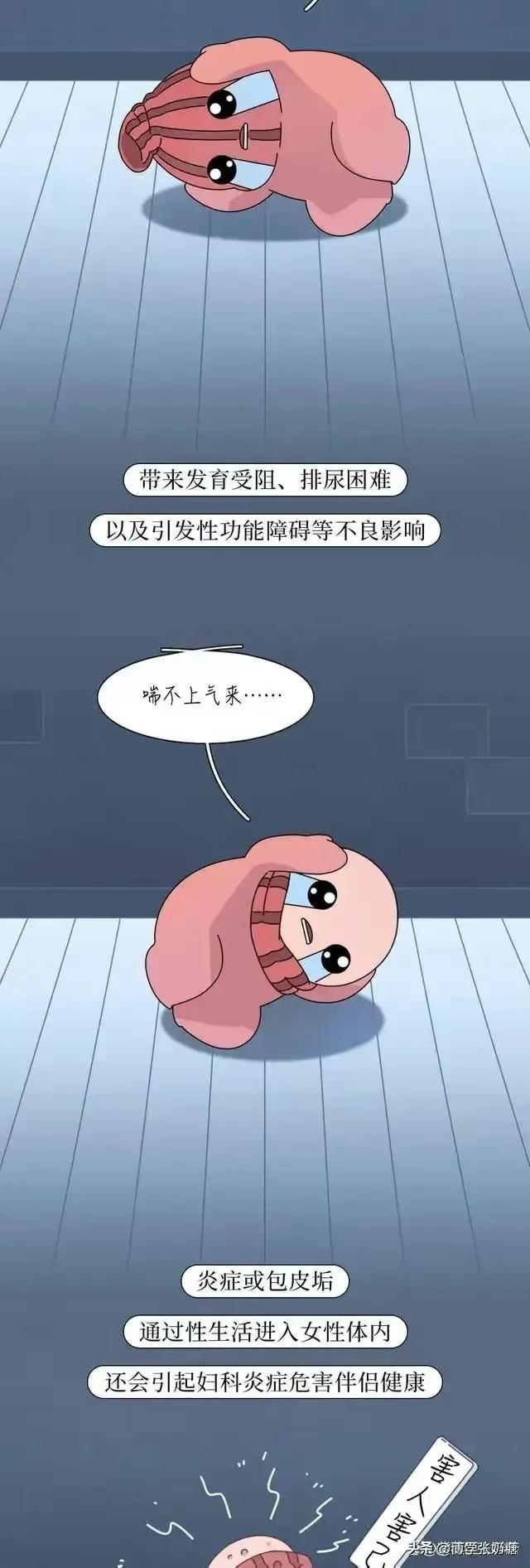 男生包皮手术水肿怎么办,男士做包皮手术多年后遗症呢