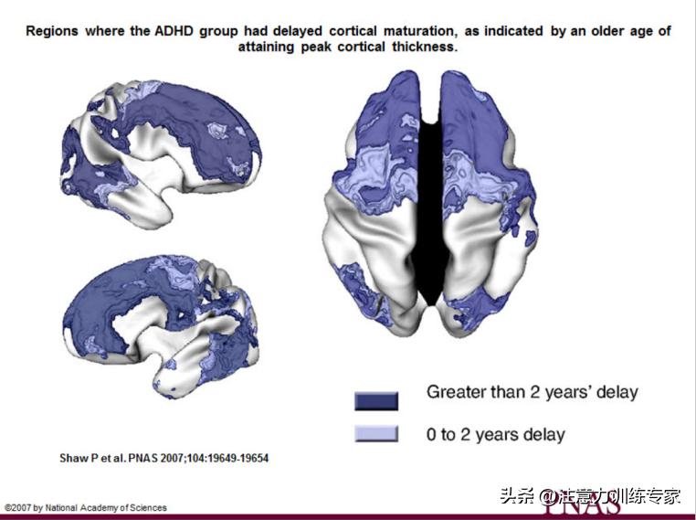 a娃矫正课程,a娃能自愈吗
