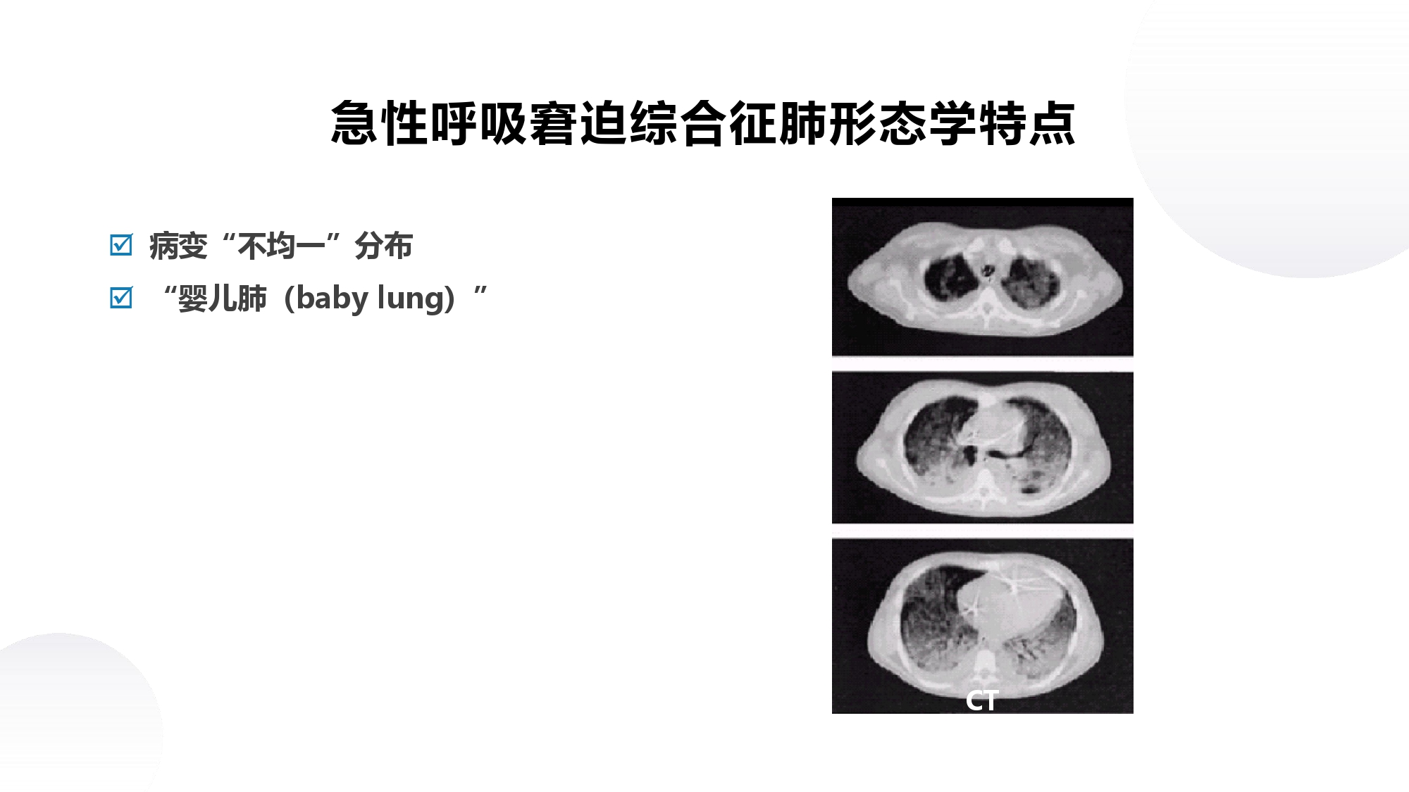 呼吸内科教学课件分享｜第十四章何为急性呼吸窘迫综合征？