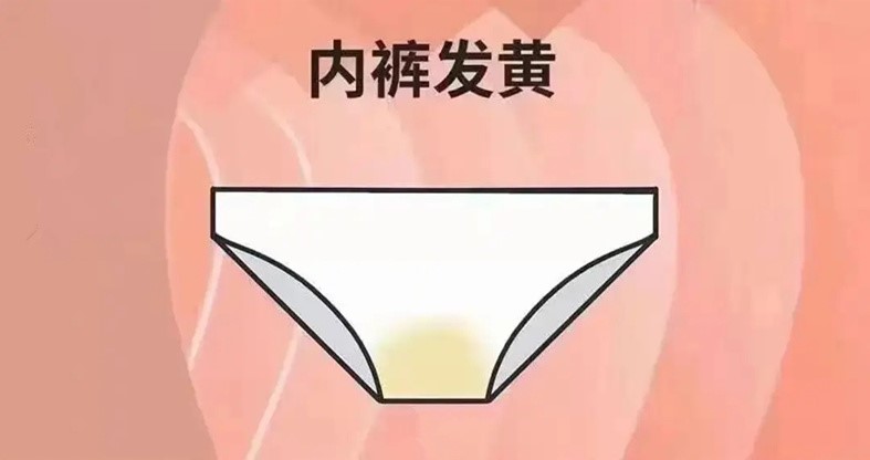 女人底裤为什么容易变黄,女生的短裤变黄是什么原因