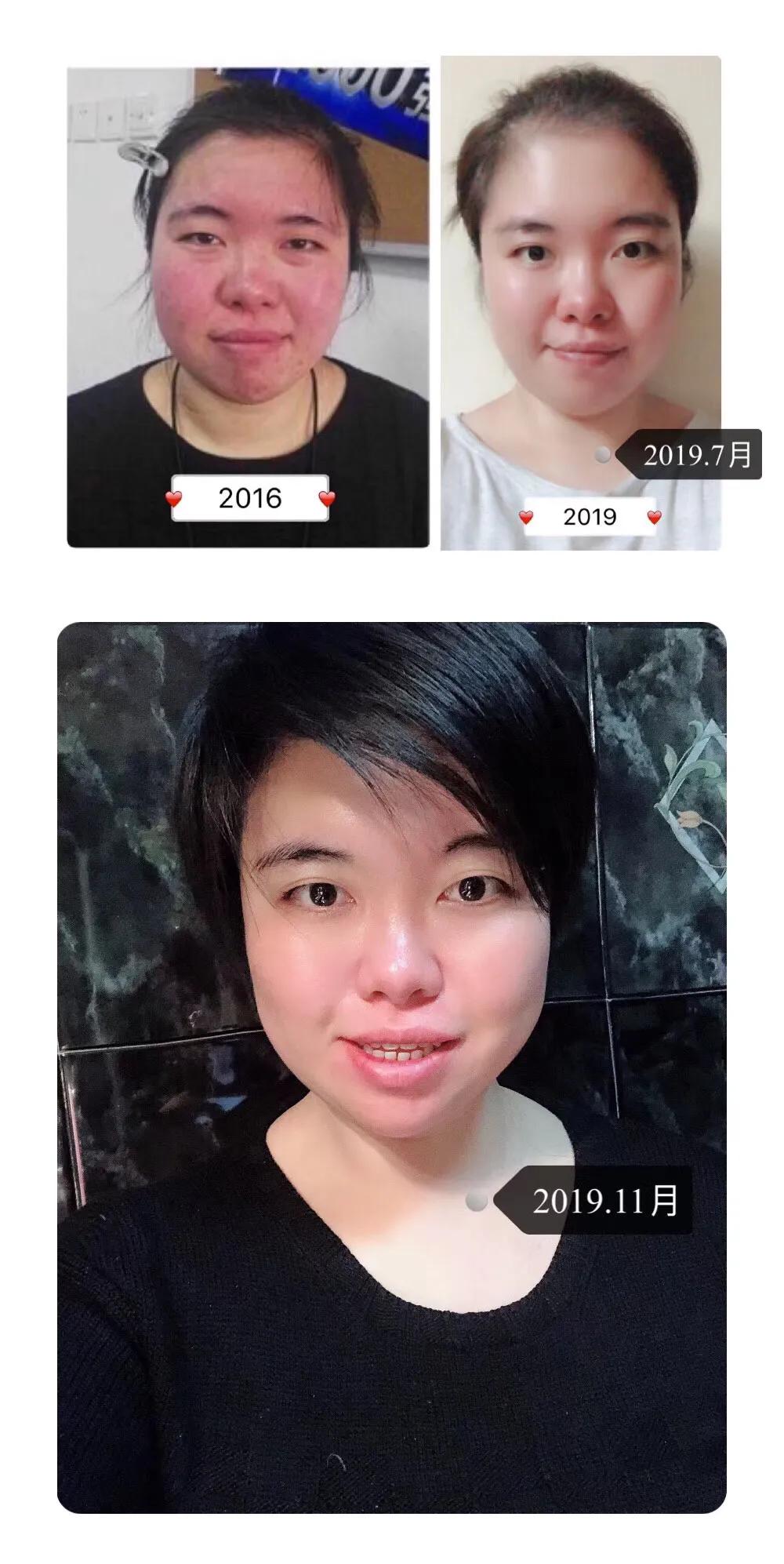 agelocspa套装怎么样,agelocspa机