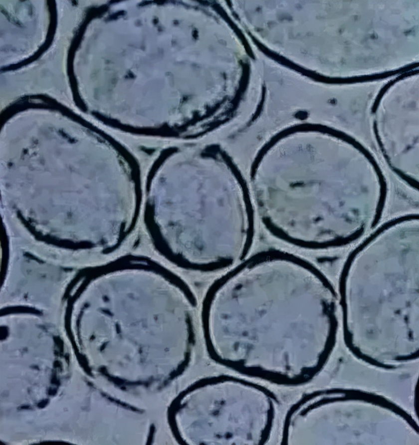 涤纶和聚酯纤维的区别,涤纶和聚酯纤维区别