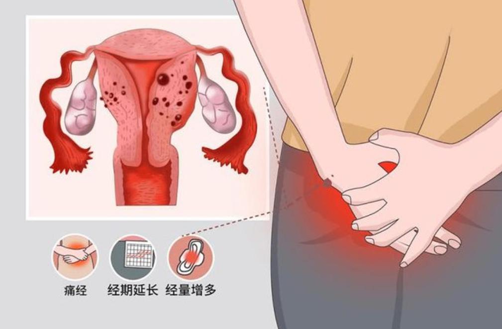 没有性的生活需要检查hpv吗,需不需要定期做妇科检查