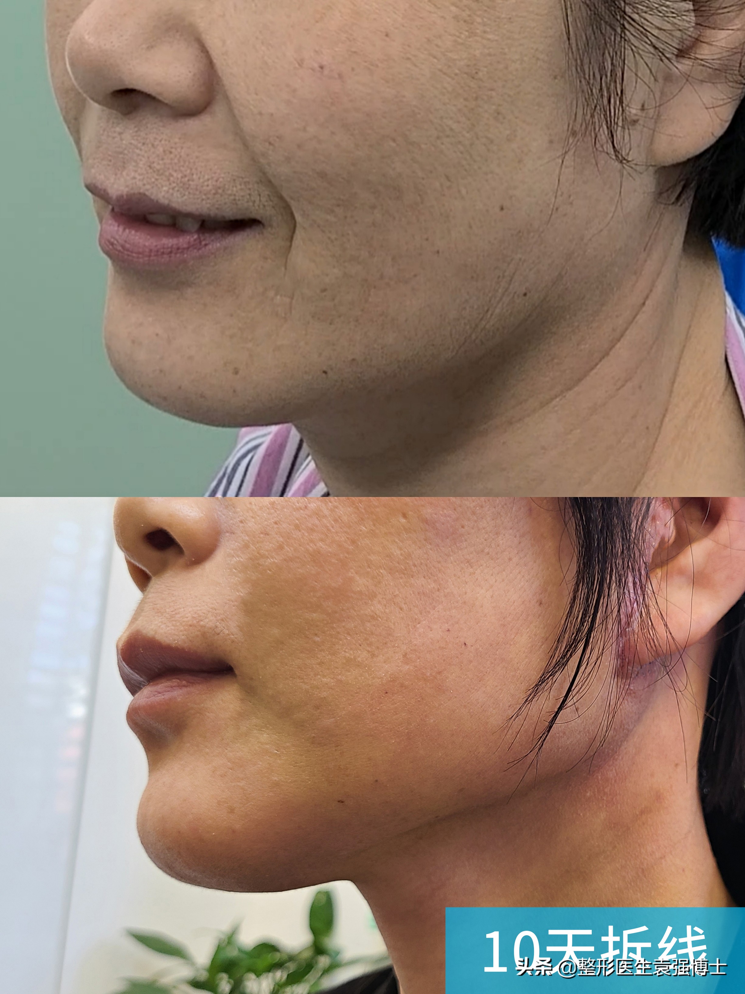 40岁以后要选择什么样的医美项目,40岁医美行业能干什么