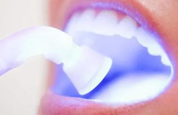 牙膏牙粉牙贴真的有用吗,美白牙贴牙膏