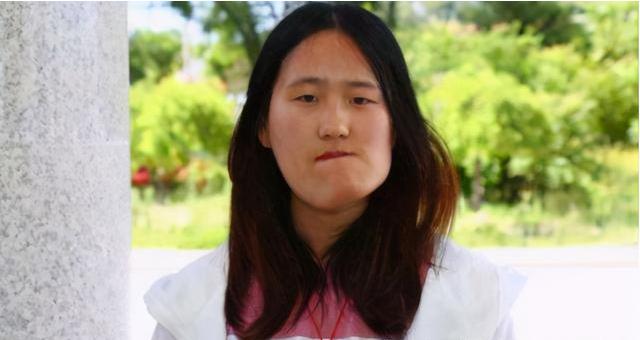 辽宁歪脸女孩，父母双亡，她整容变美女，拒百万年薪，只想当老师