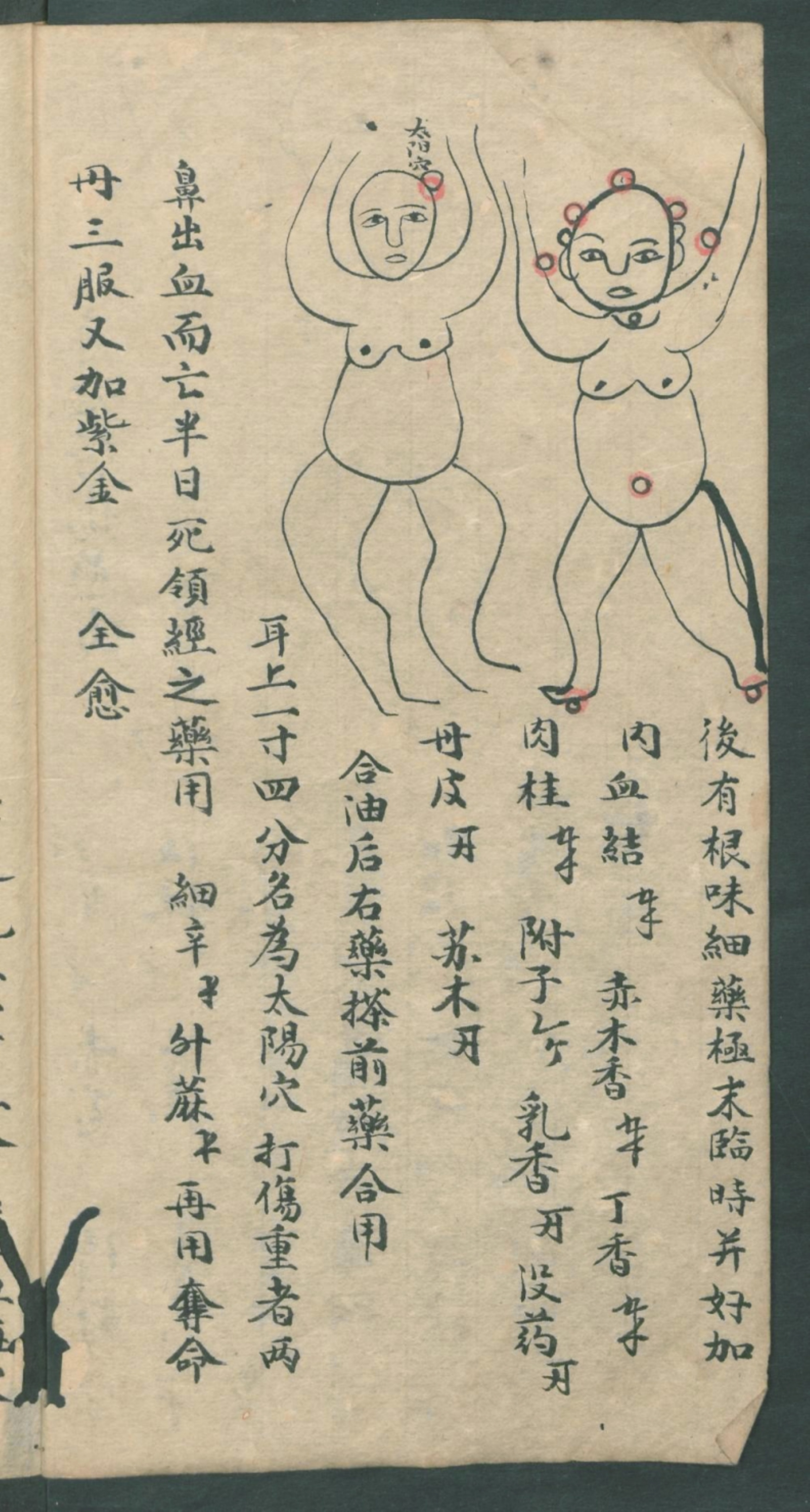 秘传跌打秘方,秘传跌打药方