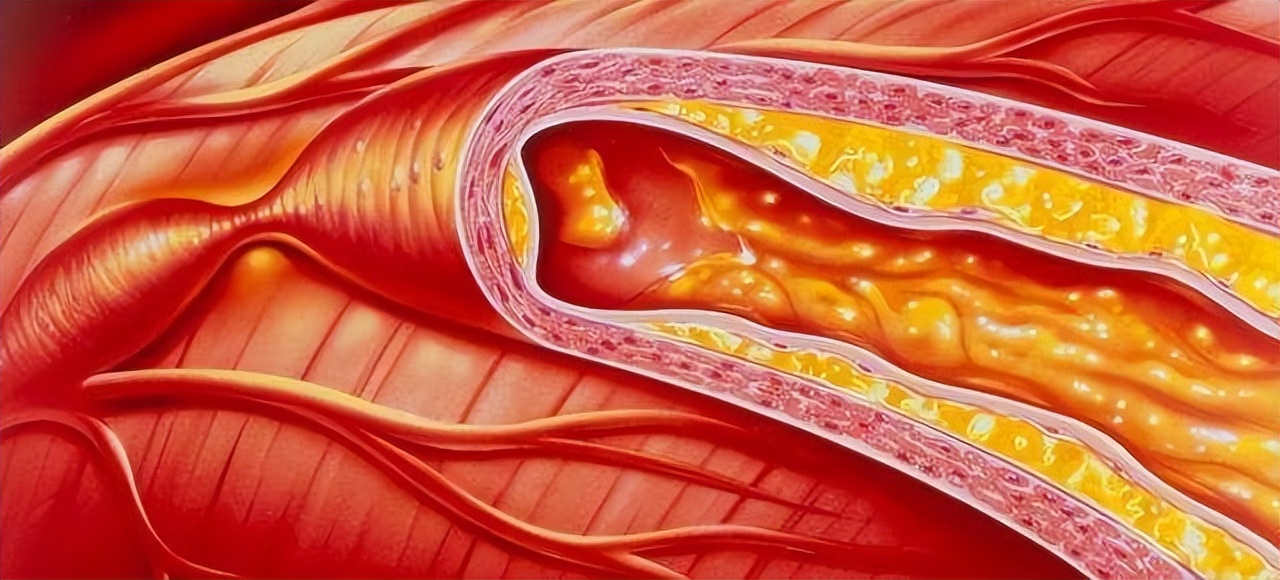 大米和玉米哪个当主食好可以减肥,减肥期间能不能把山芋和玉米吃饱