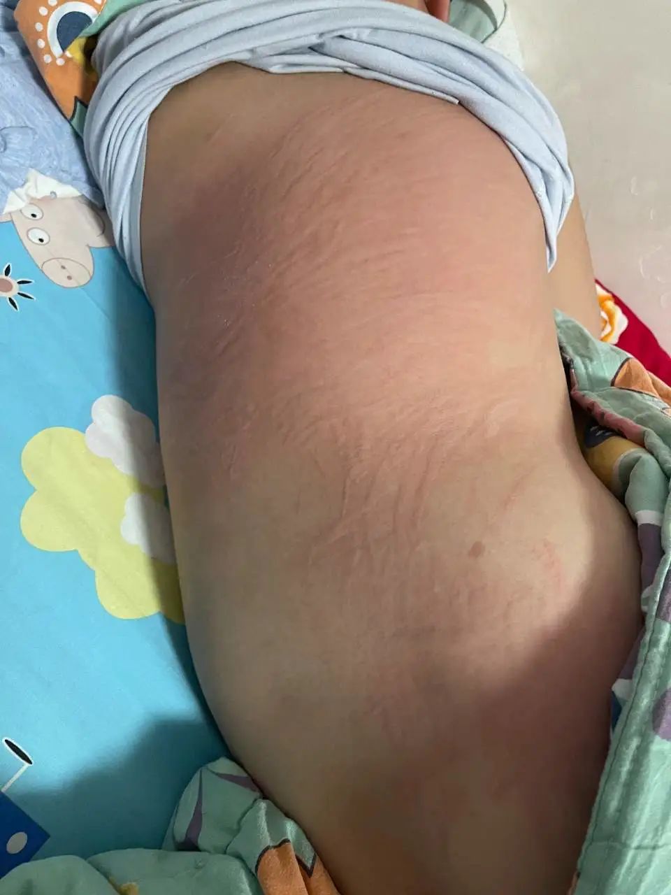 今日记录,门诊用药咨询解答记录