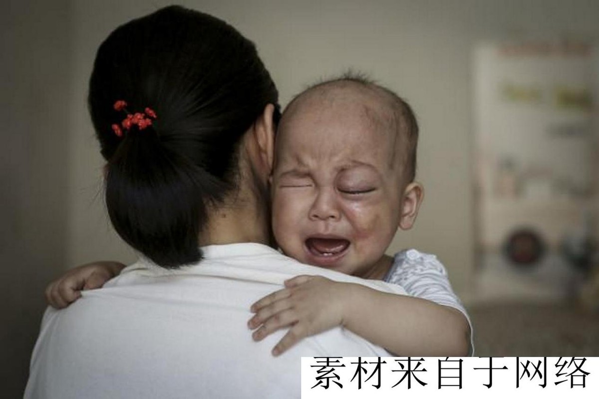 广西一男童出生玻璃眼,男婴出生37天双眼像玻璃珠