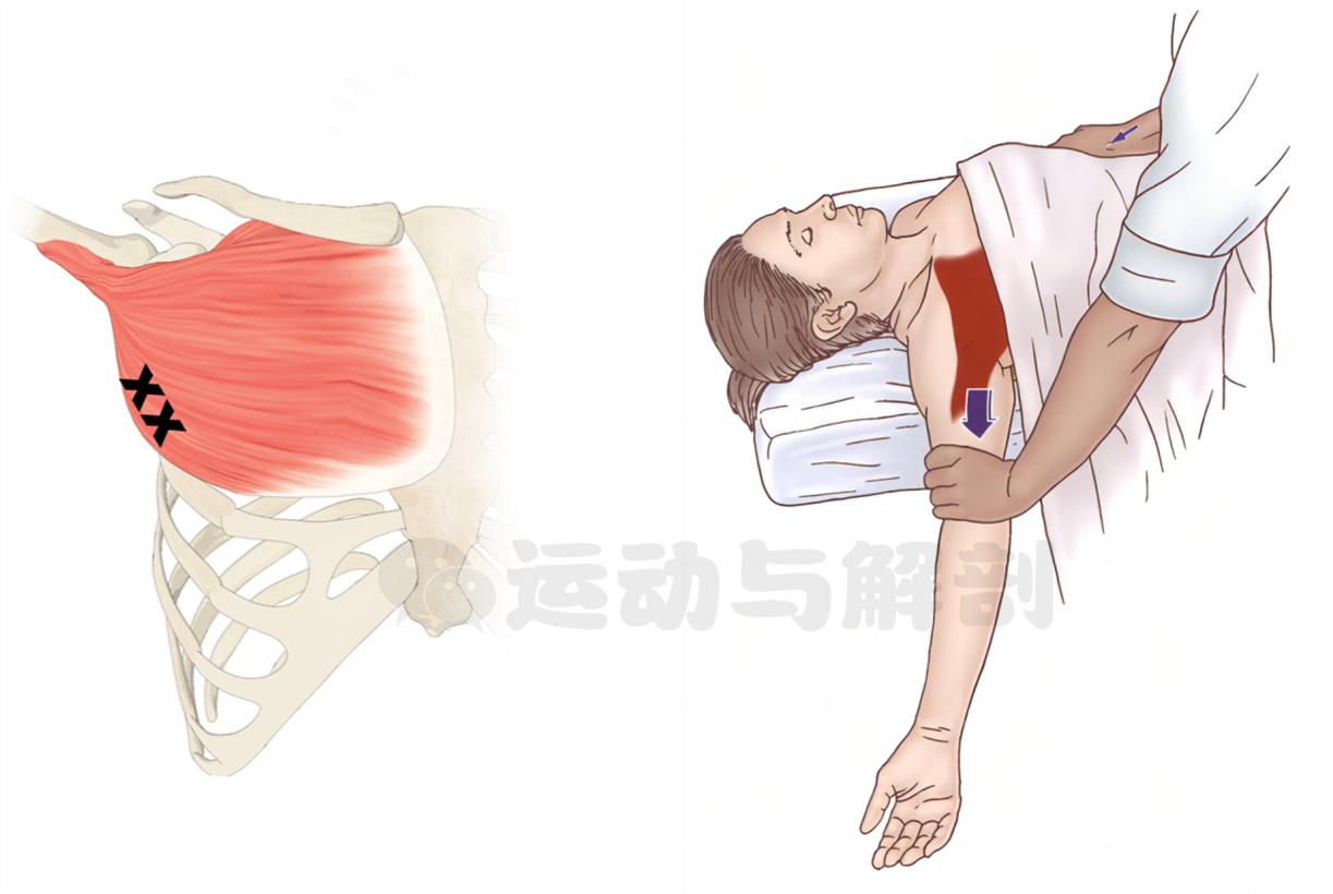 胸大肌紧绷不舒服怎么调理,胸大肌紧绷是什么原因