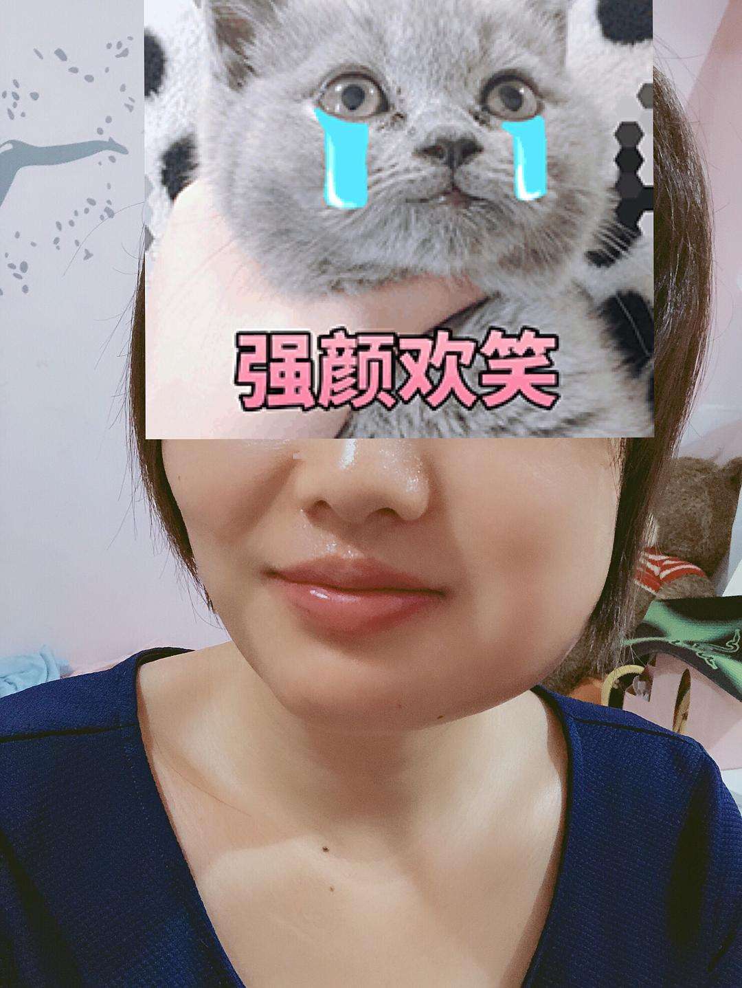 什么样的牙齿无药可救了,常见的牙齿的疾病和处理方法