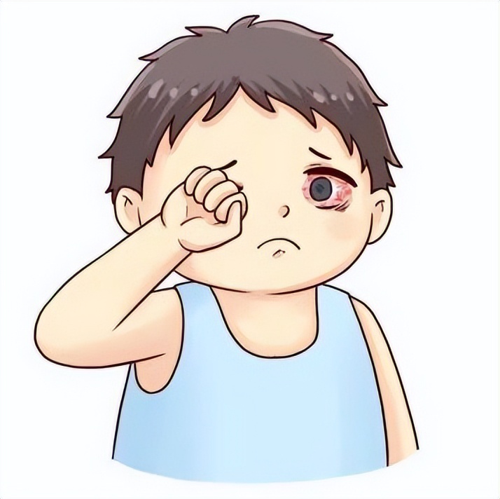 结膜炎你要注意什么,日常生活中怎样预防眼睛结膜炎