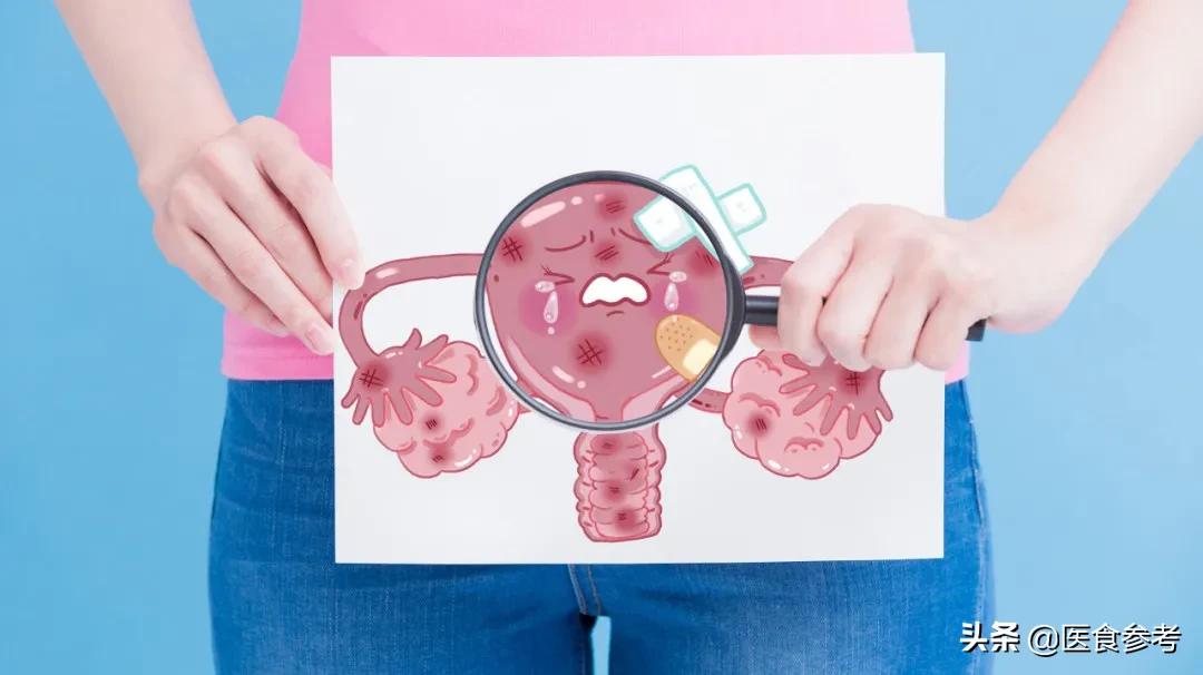 宫颈癌要怎么防范,女性得宫颈癌的5个误区