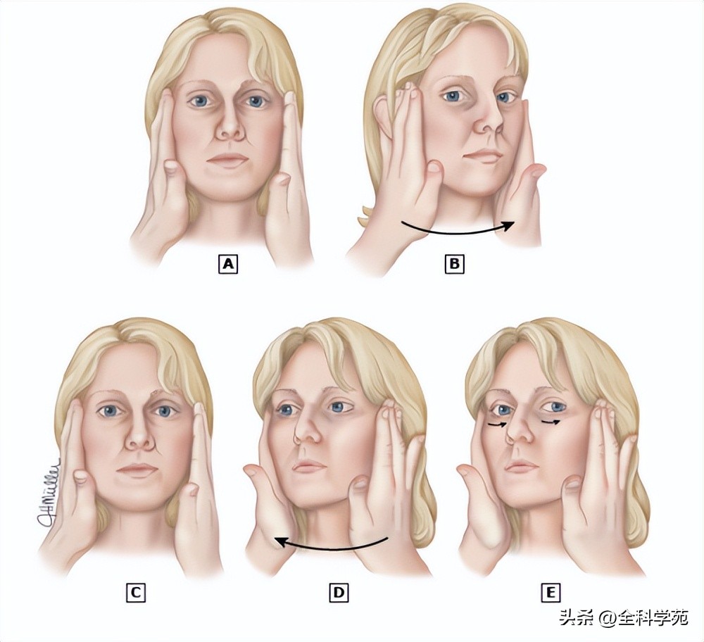 眩晕评估量表,眩晕的病情评估
