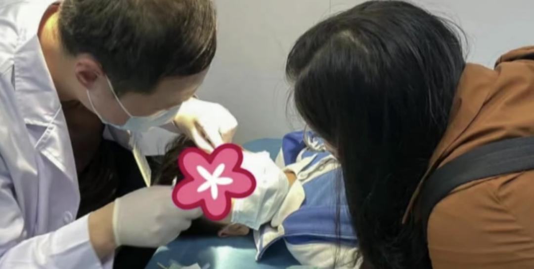 眼睛被热水溅到怎么处理,502不慎溅入眼睛要冲洗多久