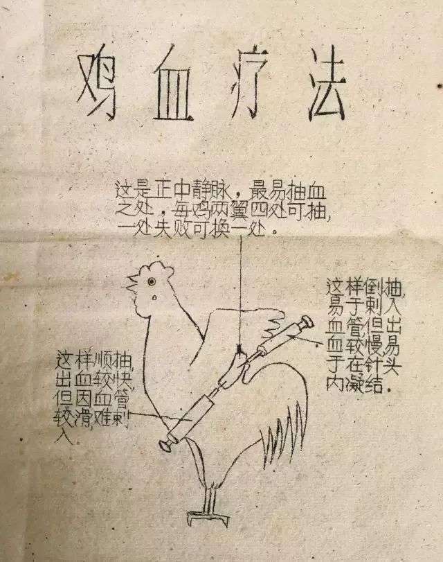 六十年代流行十年的打鸡血疗法,打鸡血真的有效吗