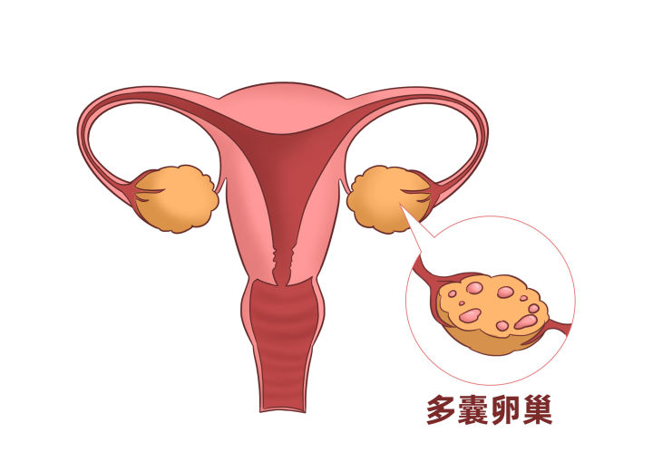 90后投保哪款保险比较适宜,可以带病投保的保险推荐