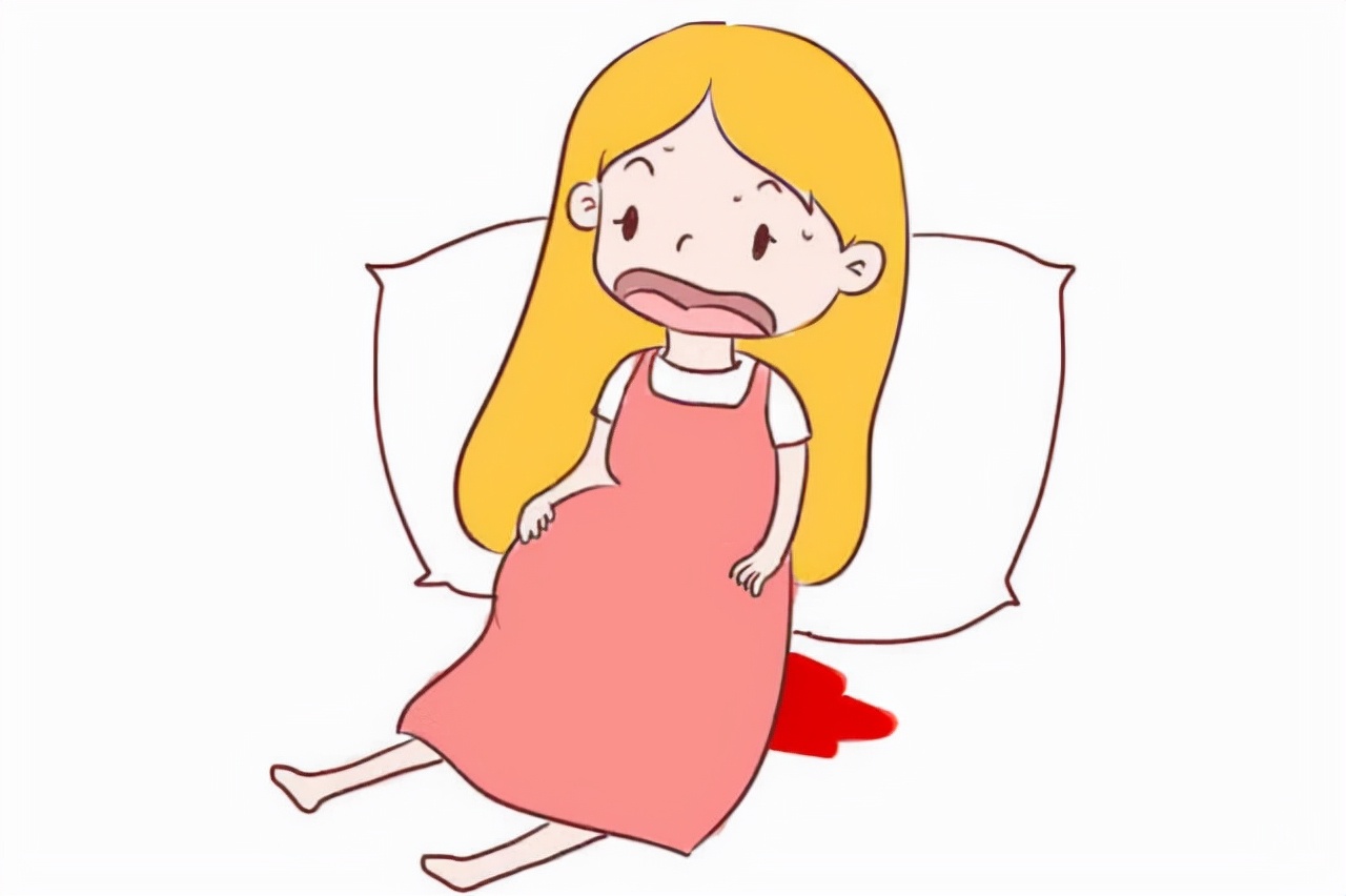 怀孕了一直出血是已经流产了吗,怀孕后大出血流产了是什么原因