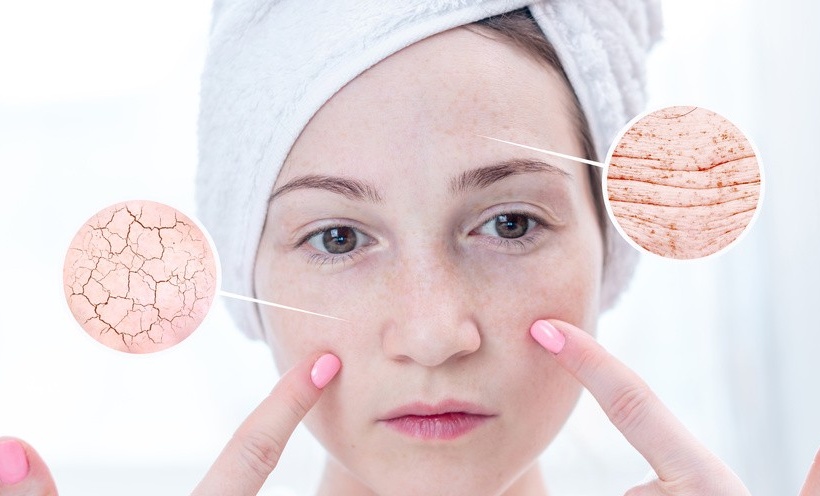 凡士林有什么用途在哪里,凡士林干皮可以用吗