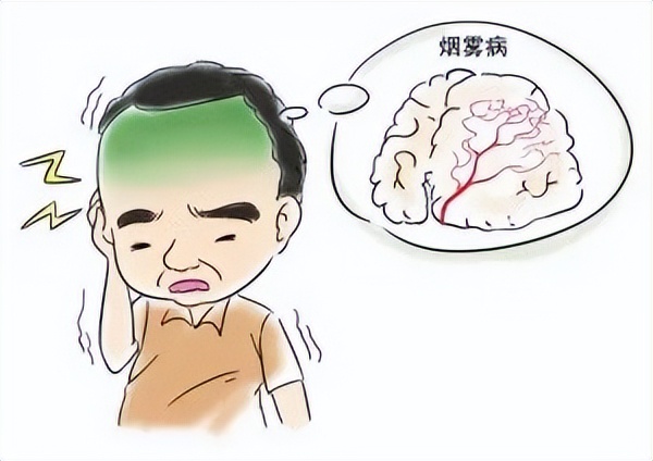 13宀佺敺瀛╃儫闆剧梾鎬庝箞寰楃殑,13宀佺敺瀛╃獊鐒惰剳鎰熸煋