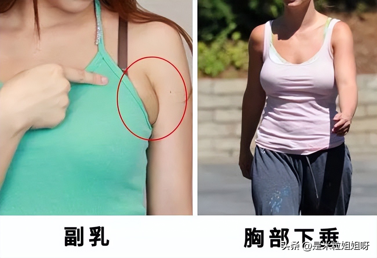 腋下副乳和手臂拜拜肉怎么练哑铃,哑铃瘦副乳和腋下最快的方法