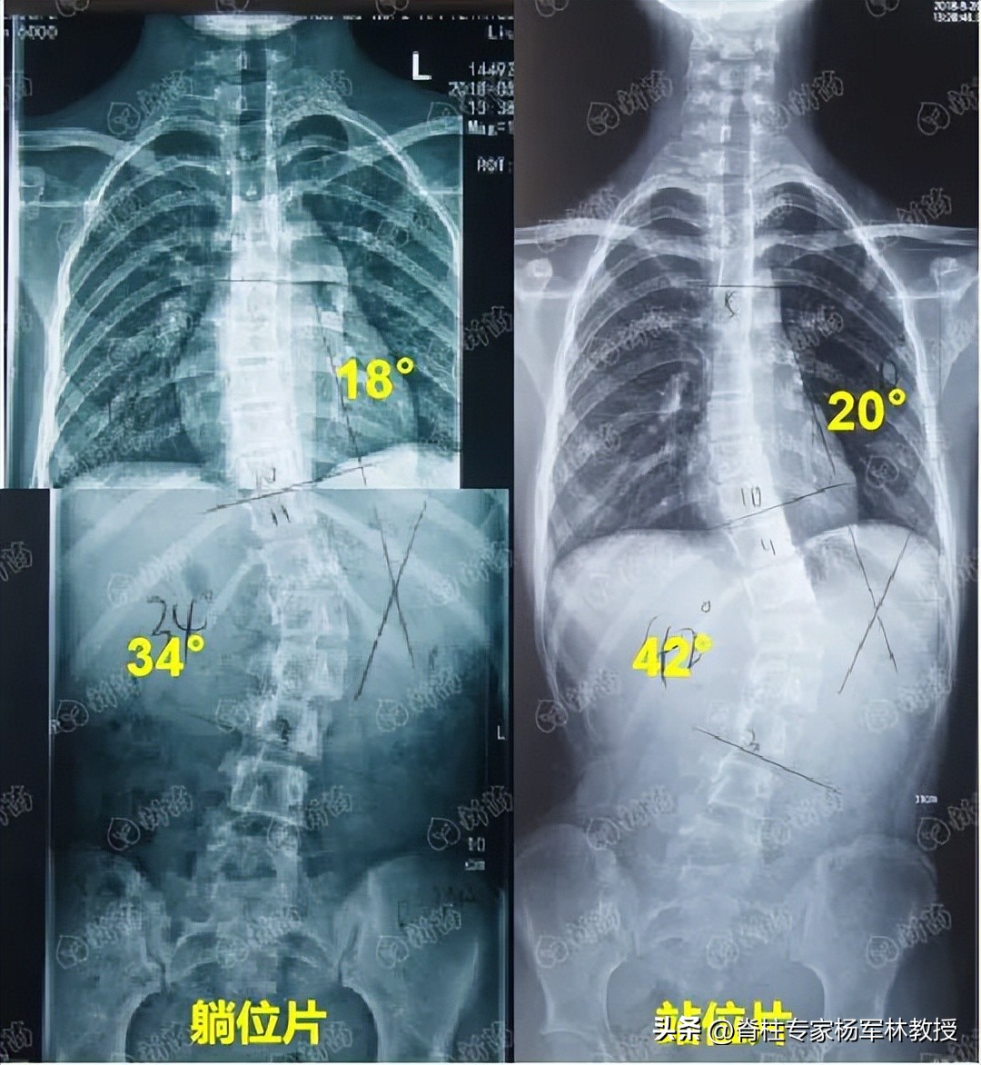 x光片不清晰是拍摄人员的问题吗,x光片可能会拍错吗