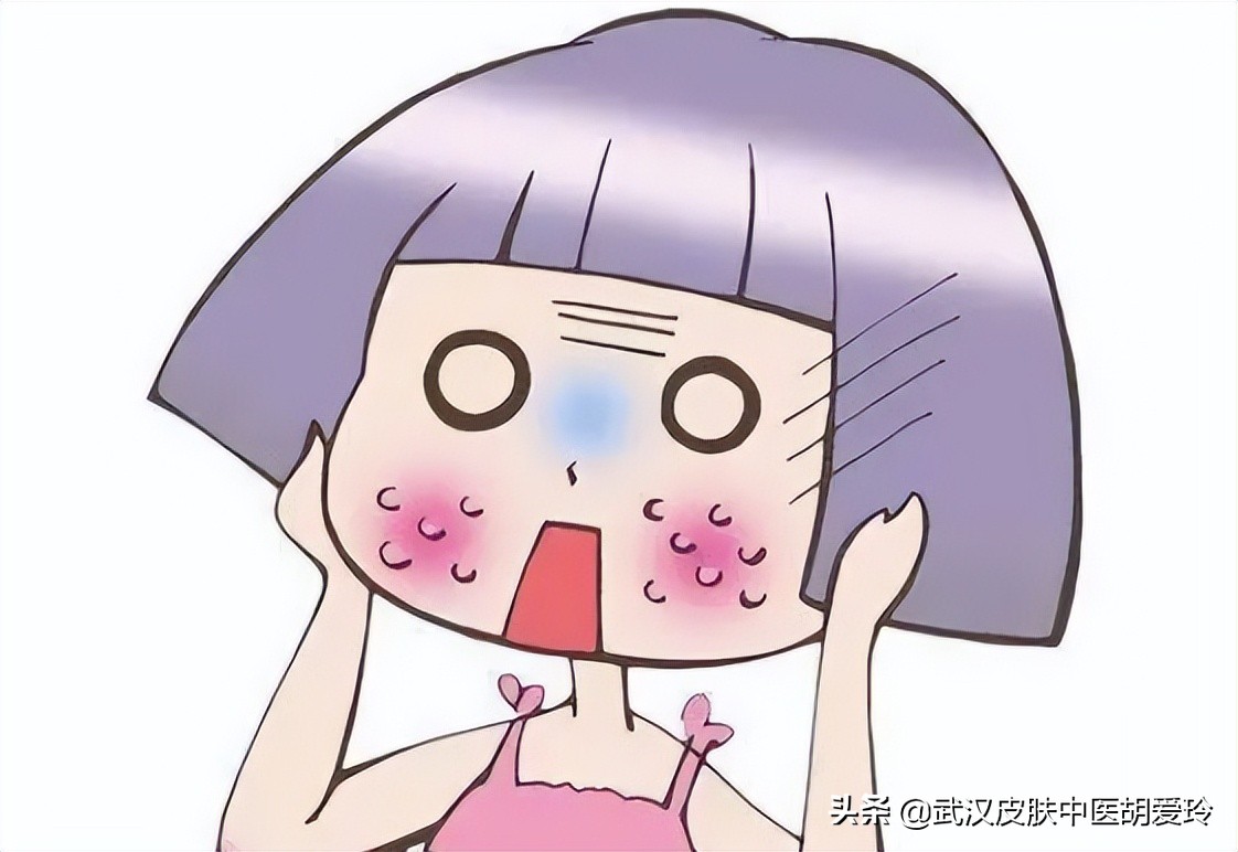 脸颊红肿是什么原因引起的,脸颊红是什么原因