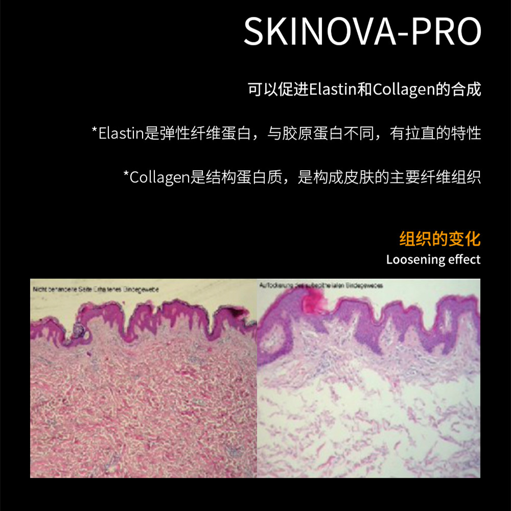 肌肤敏感美容仪推荐哪款,肌肤深层抗老用什么美容仪