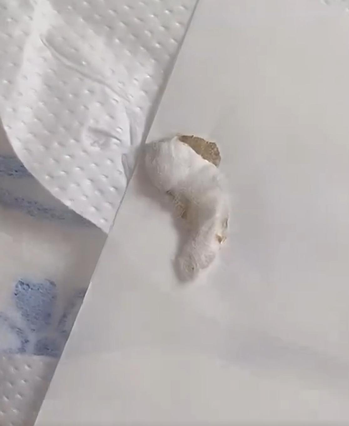 女子称卫生巾里有虫子,女子称卫生巾中发现虫