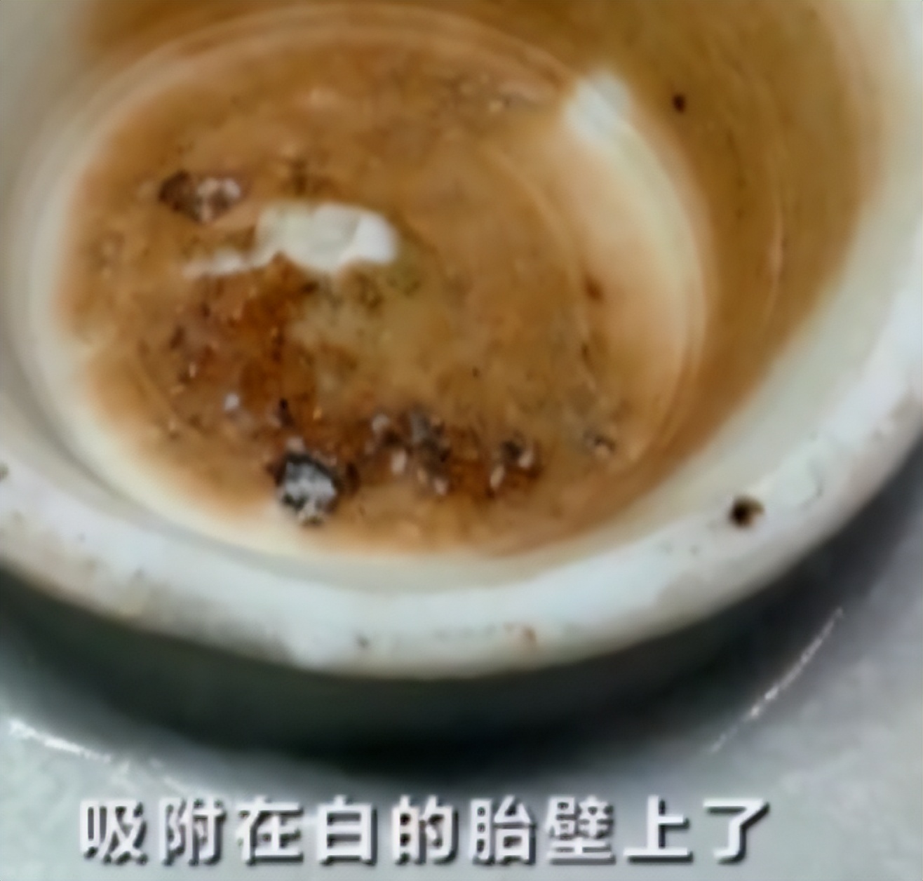 “一锤定音”荒唐鉴定举例（9）：自相矛盾的“塌底”